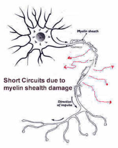 nerve mylein shealth damage